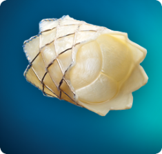 medtronic melody heart valve